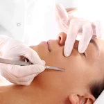 Services dermaplaning