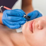 Services electrolysis thumbnail