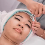 Services microdermabrasion
