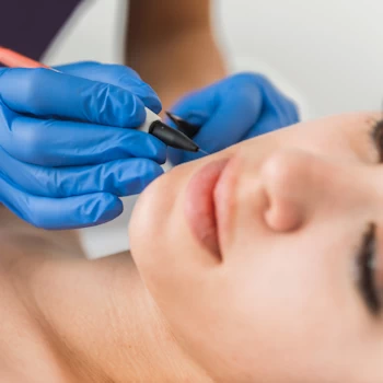 Services menu electrolysis